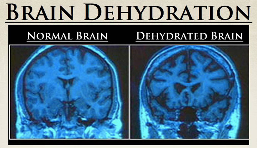 brain deshidratado